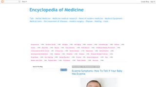 لقطة شاشة لموقع Encyclopedia of Medicine
بتاريخ 21/09/2019
بواسطة دليل مواقع خطوات