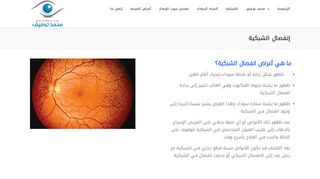لقطة شاشة لموقع علاج انفصال الشبكية في مصر
بتاريخ 22/09/2019
بواسطة دليل مواقع خطوات